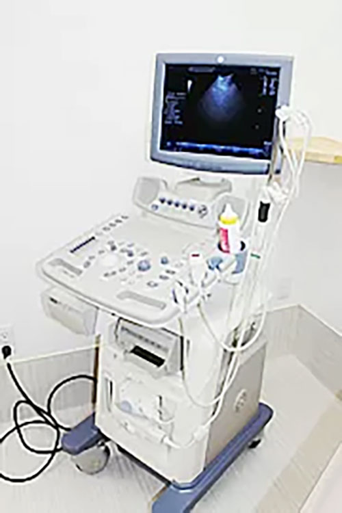 カラー超音波診断装置